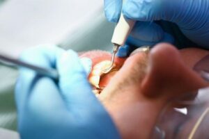 getting tooth checked by a dentist
