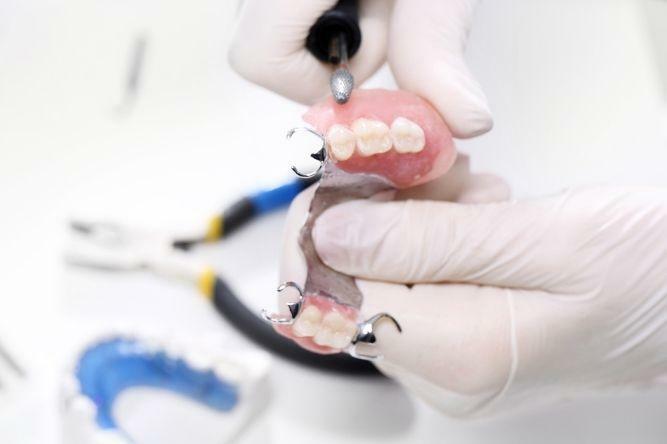 teeth model being shown for dentures