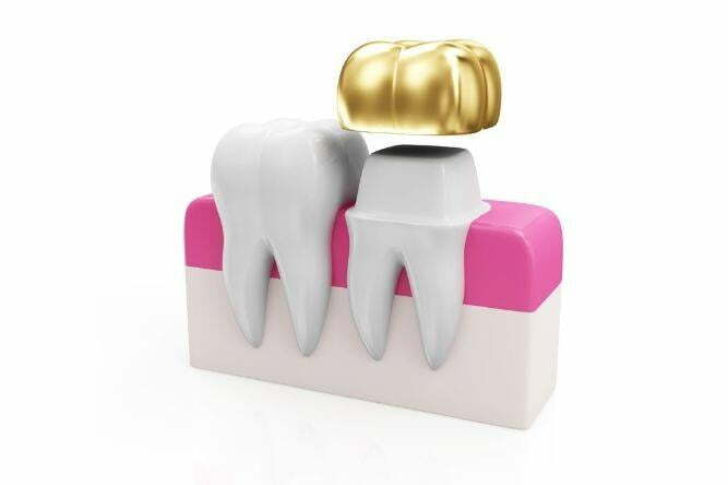 tooth display with a crown over one
