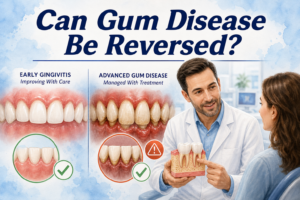 Featured image for whether gum disease can be reversed